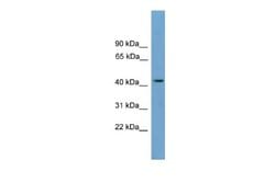 MFSD3 Rabbit anti-Human, Polyclonal, Novus Biologicals 0.1 mL | Buy Online | Novus Biologicals | Fisher Scientific